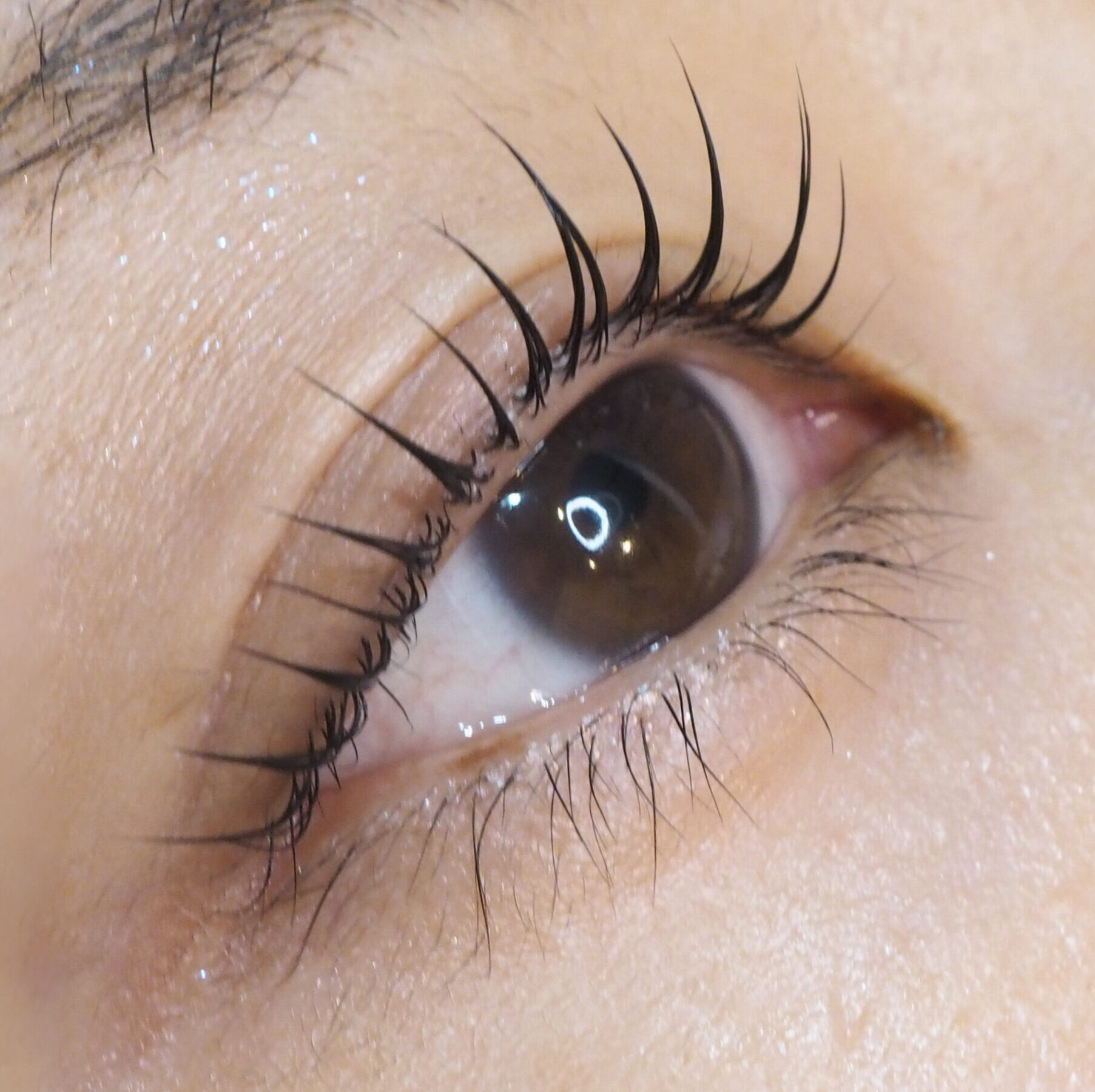 eye